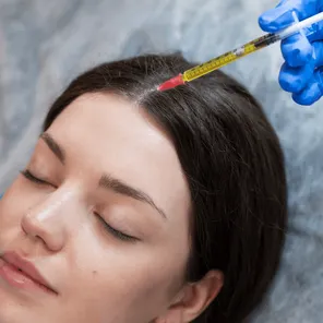 Плазмолифтинг лицо