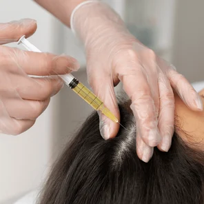 Плазмолифтинг головы