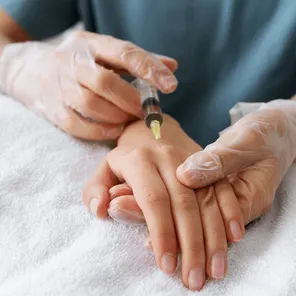 Плазмолифтинг кожи рук