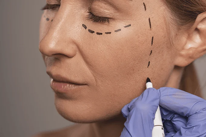 Контурная пластика лица в Челябинске — подтяжка лица без скальпеля и без разрезов