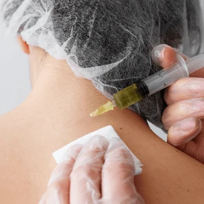 Плазмолифтинг кожи лица, шеи и декольте