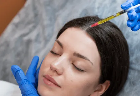 Плазмолифтинг лица в Челябинске — омоложение вашей собственной плазмой без инъекций чужеродных препаратов