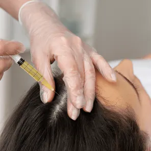 Плазмолифтинг головы